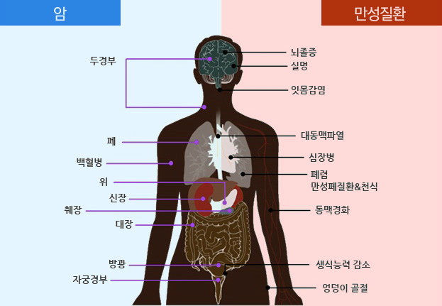 지금 타는 건 담배일까요? 아니면 당신 생명일까요?
